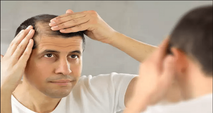 دلایل ریزش مو و ریزش ابرو چیست ؟