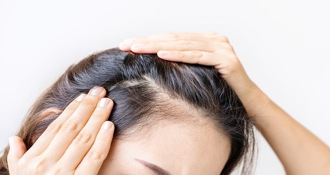  روش های کاشت مو چند نوع هستند؟
