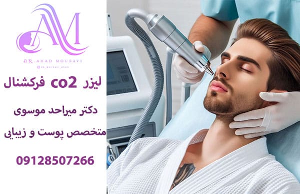 لیزر co2 فرکشنال