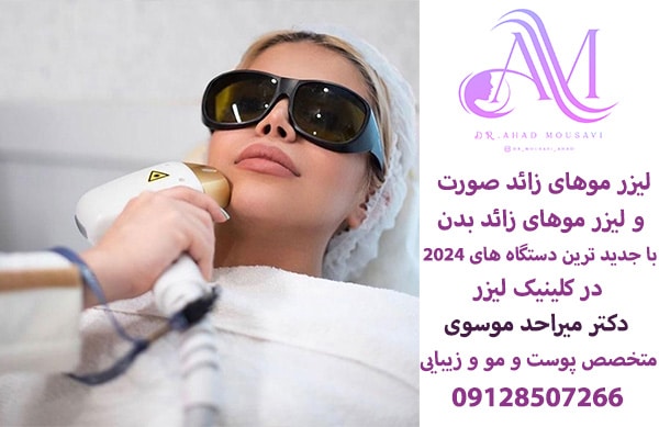 لیزر موهای زائد صورت و بدن