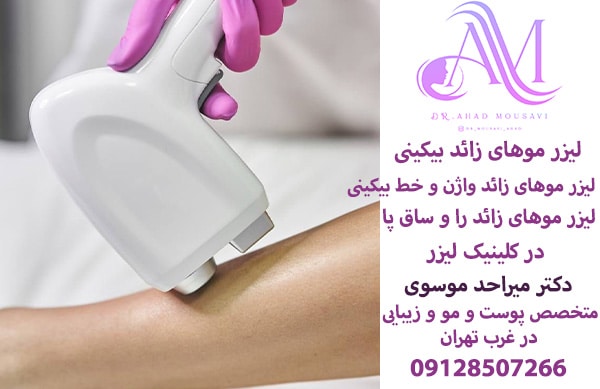 لیزر موهای زائد واژن و خط بیکینی