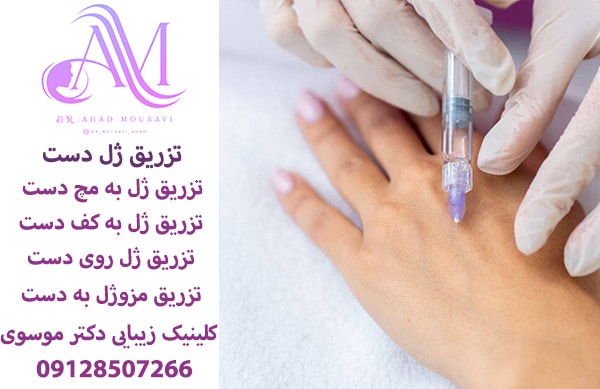 تزریق ژل به دست