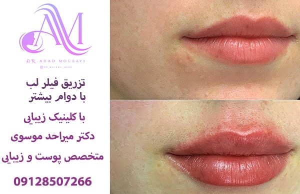 ماندگاری ژل لب