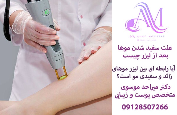 علت سفید شدن موها بعد از لیزر