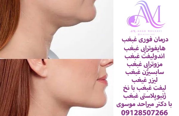 بهترین راه درمان غبغب