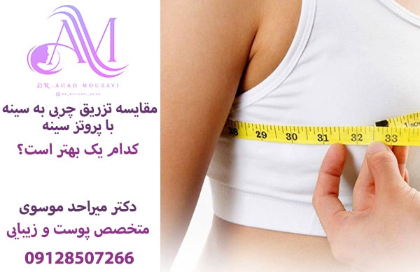 مقایسه تزریق چربی سینه با پروتز سینه