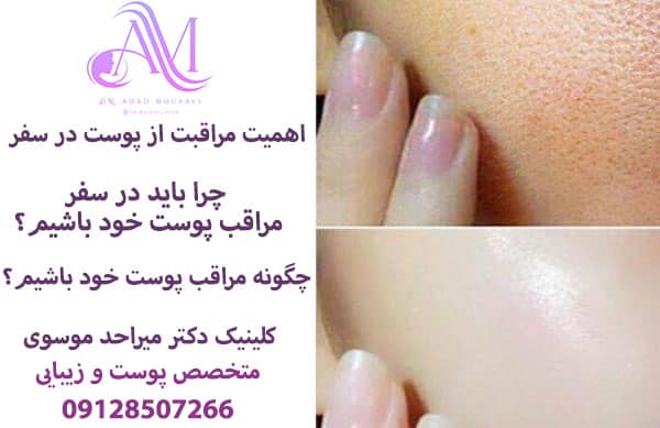 اهمیت مراقبت از پوست در سفر