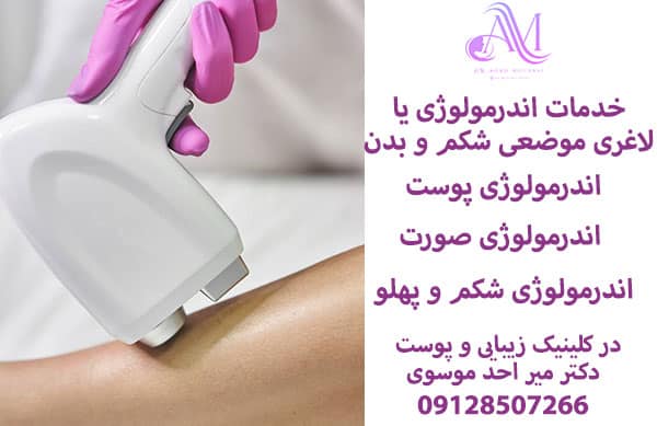 خدمات اندرمولوژی یا LPG