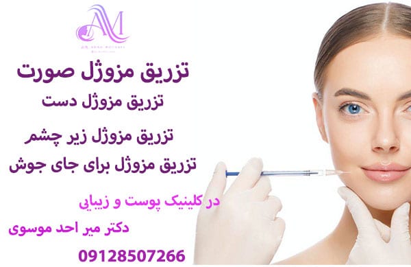 تزریق مزوژل صورت
