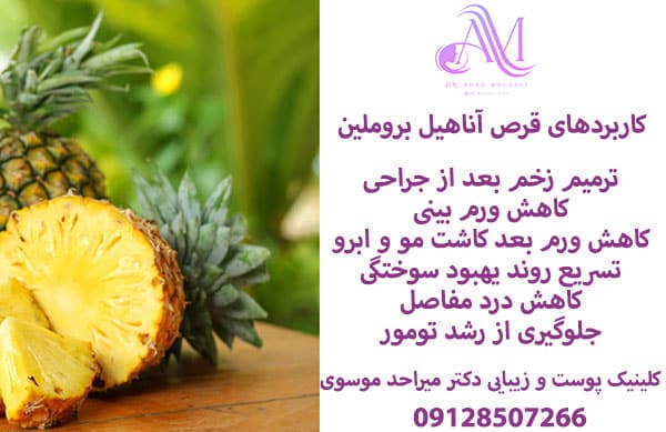 کاربردهای قرص آناهیل