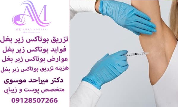 فواید بوتاکس زیر بغل