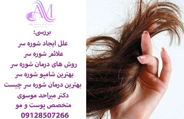 علل ایجاد شوره سر