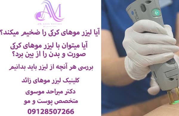 آیا لیزر موهای نازک را ضخیم می کند؟