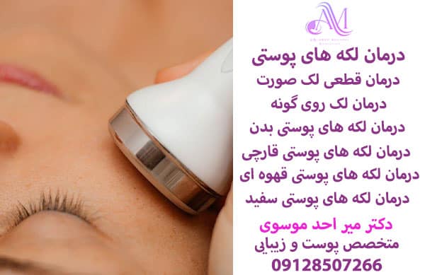 درمان لکه های پوستی