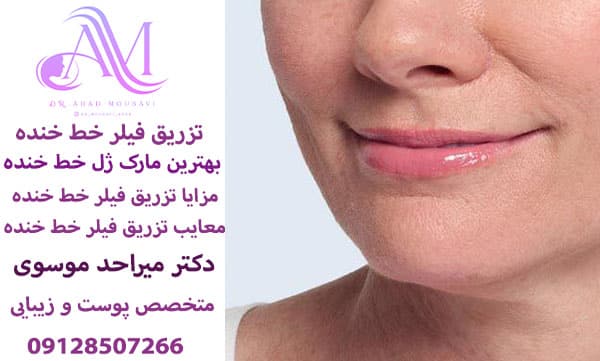 بهترین مارک ژل خط خنده