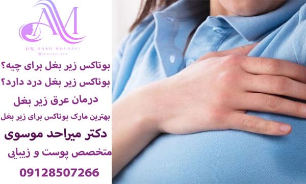 بوتاکس زیر بغل برای جلوگیری از تعریق