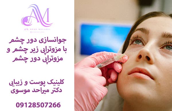 مزوتراپی ریز چشم برای رفع چروک