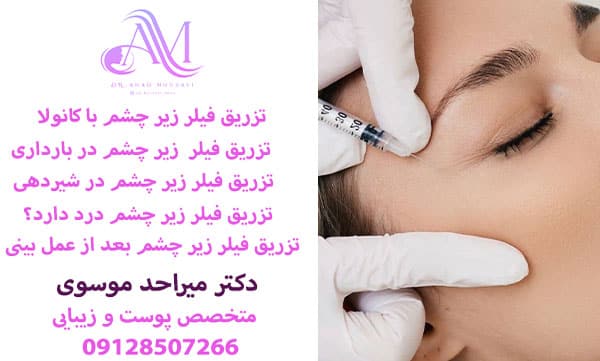 خدمات تزریق فیلر زیر چشم