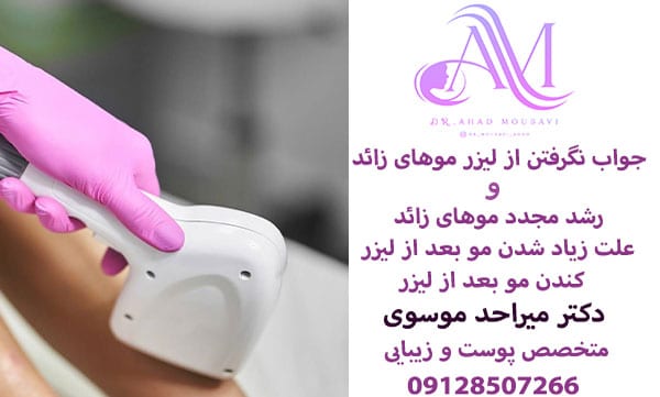 جواب نگرفتن از لیزر موهای زائد