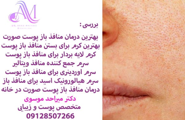 بهترین درمان منافذ باز پوست صورت
