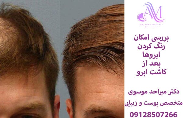 رنگ کردن ابرو بعد از کاشت ابرو طبیعی