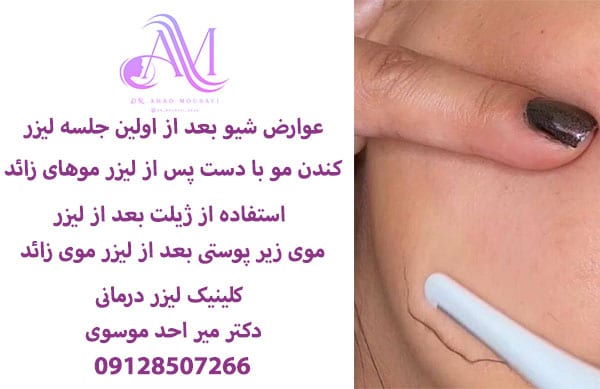 عوارض شیو بعد از لیزر