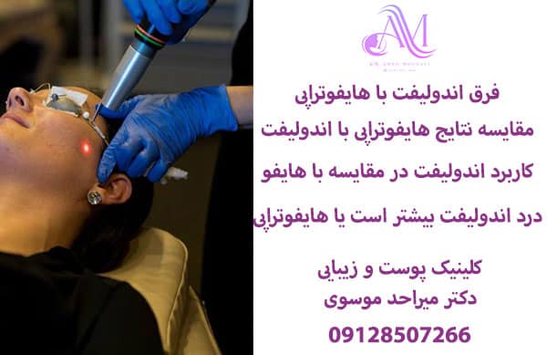 فرق اندولیفت با هایفوتراپی
