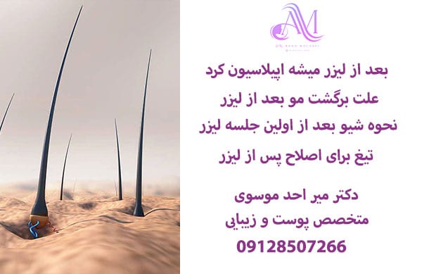 بعد از لیزر میشه اپلاسیون کرد