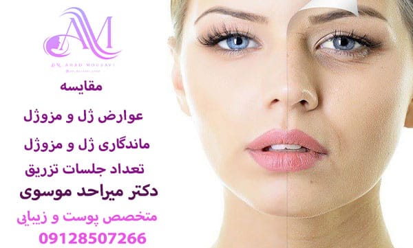 مقایسه تفاوت های ژل و مزوژل