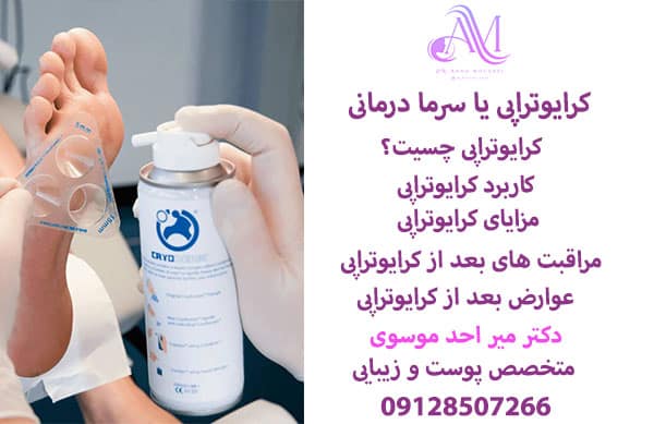 کرایوتراپی یا سرما درمانی