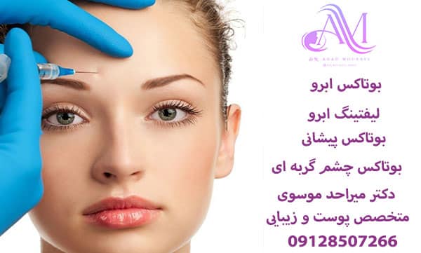 بوتاکس ابرو