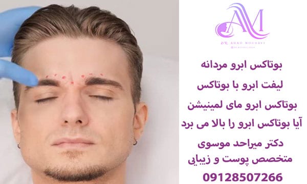 لیفت ابرو با بوتاکس