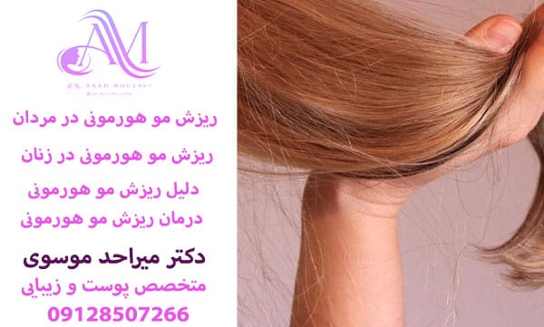 ریزش مو هورمونی در زنان