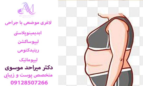 لاغری موضعی با جراحی