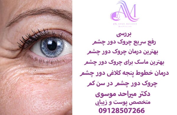چروک دور چشم