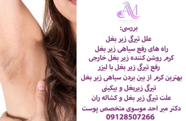 رفع تیرگی زیر بغل با لیزر
