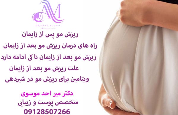 ریزش مو پس از زایمان