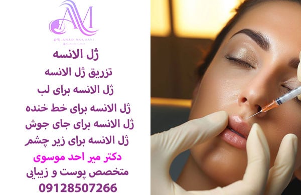 تزریق ژل الانسه