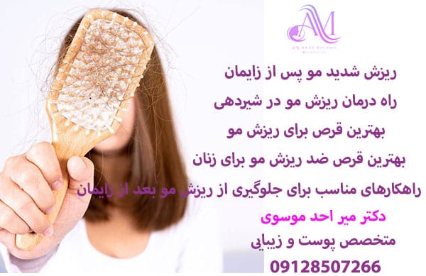 ریزش مو شدید بعد از زایمان