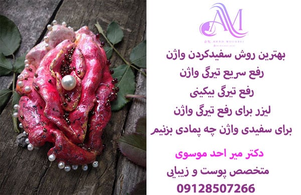 رفع سریع تیرگی واژن