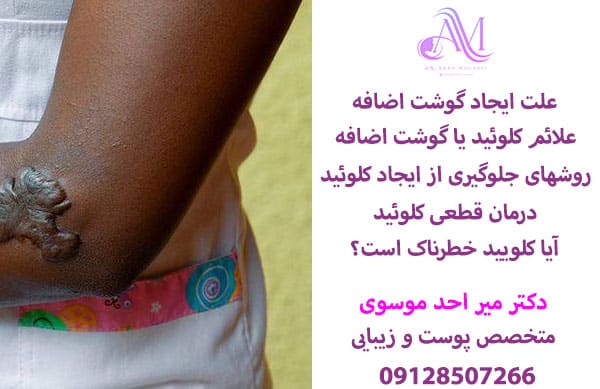 علت ایجاد گوشت اضافه