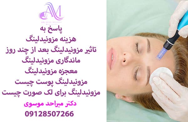 ماندگاری مزونیدلینگ