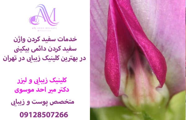 روشن کردن واژن