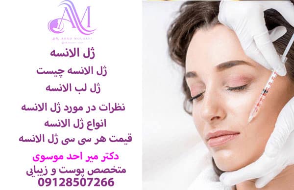 ژل الانسه چیست