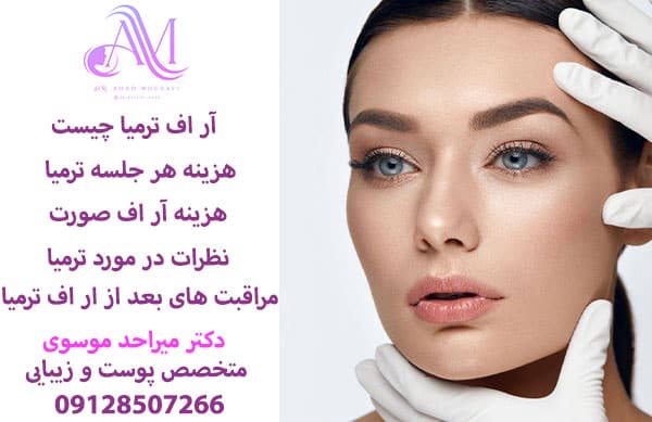 آر اف ترمیا چیست