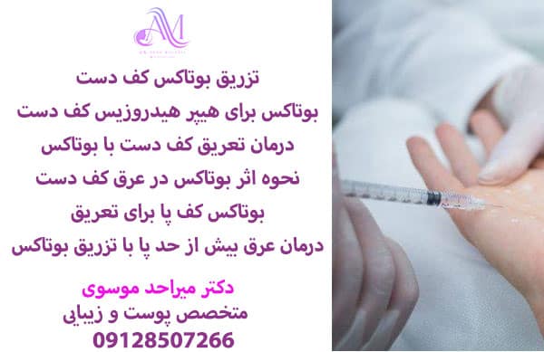 تزریق بوتاکس کف دست