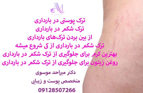 ترک پوستی در بارداری