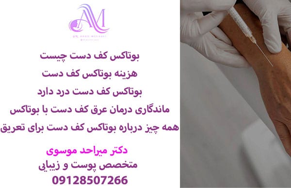 هزینه بوتاکس کف دست