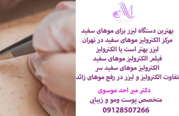 الکترولیز موهای سفید