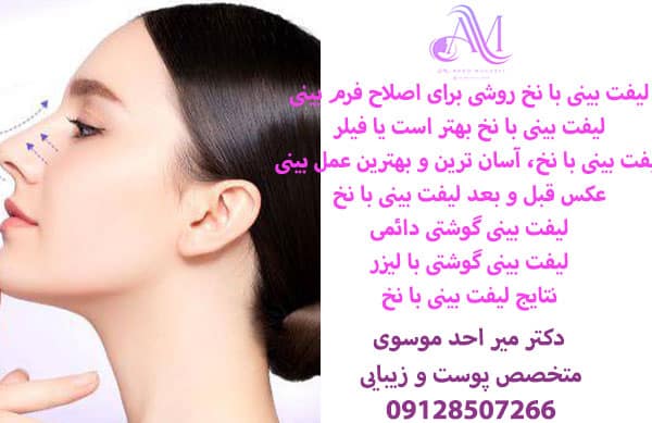 ماندگاری لیفت بینی با نخ